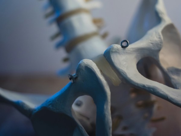 Bekkenkontroll: 4 steg til bedre kroppsholdning, rygghelse og&nbsp;rumpestyrke